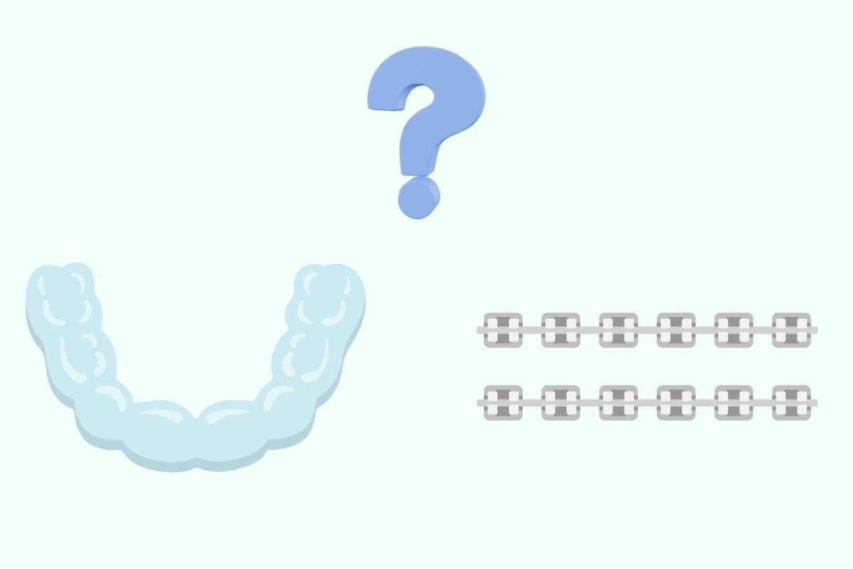 A graphic illustration depicts the choice between Invisalign and braces that many teenagers face today. Two of the most commonly used appliances include metal braces and Invisalign. (Graphic illustration by Emily Paschall)